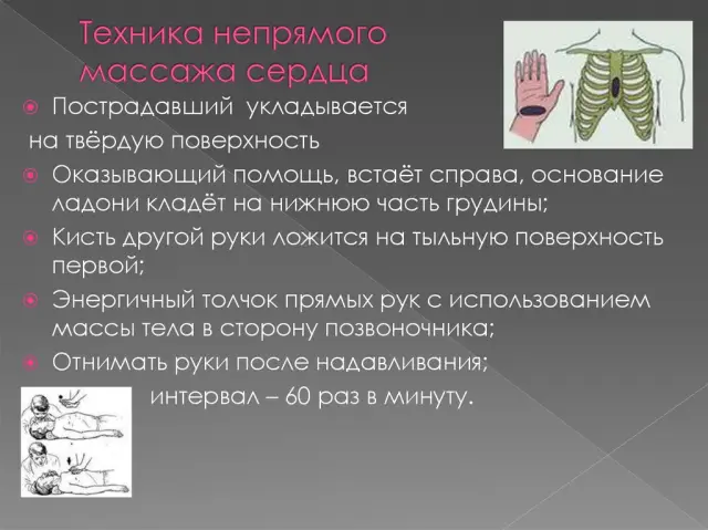 Как именно выполнять непрямой массаж сердца?