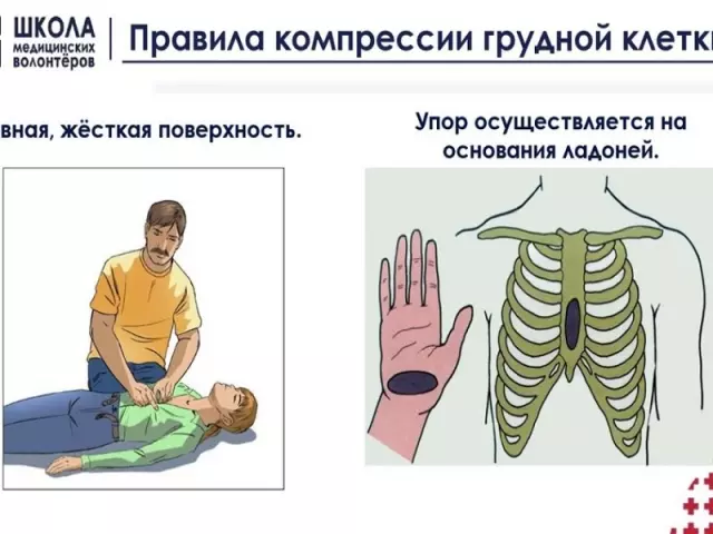 Как правильно выполнять массаж сердца: шаг за шагом